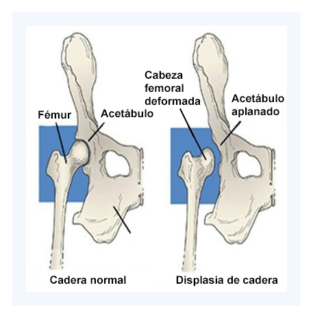 Tratamiento displasia cadera en perros Shiba Inu: Guía experta y consejos